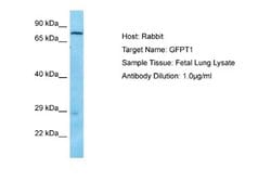GFPT1 Rabbit anti-Human, Polyclonal, Novus Biologicals 0.1 mL | Buy Online | Novus Biologicals | Fisher Scientific